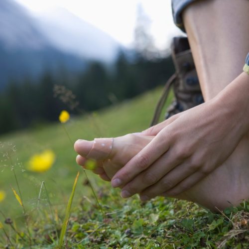 Why Do I Lose Toenails When Hiking? How to prevent losing toenails when hiking